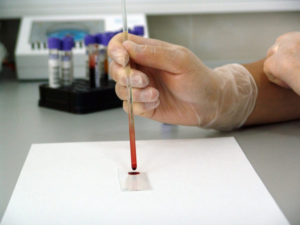 blood sample lab laboratory medical drop glass research 1358702